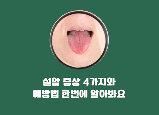 설암 증상 4가지와 예방법 한번에 알아봐요!
