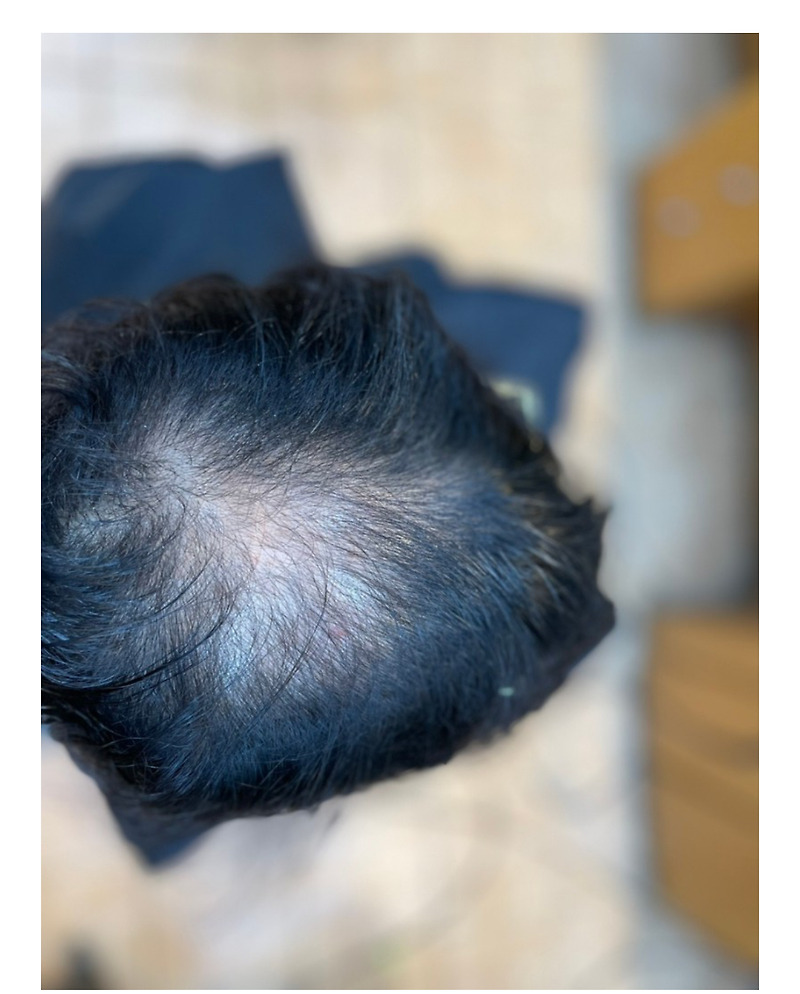 제주도에서 혼자옵서예 남여탈모성형펌 부산사상르네시떼미용실/ 대구진해신항감만녹산대저울산구미양산김해장유덕계밀양경주창원마산사천진주남해하동개금주례당감