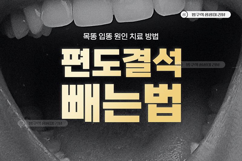 편도결석 빼는법과 생기는이유, 안전한 6
