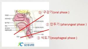 연하검사(VFSS) 이렇게 합니다