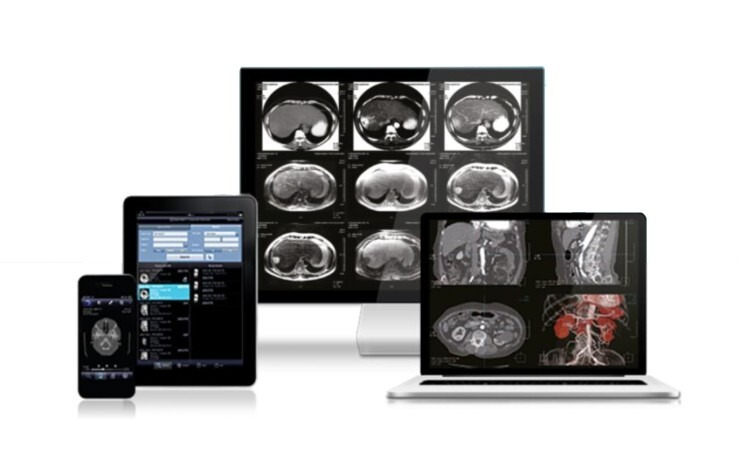 [소식] 일산백병원, CT·MRI 신속·정확한 판독 가능 '차세대 PACS 도입'