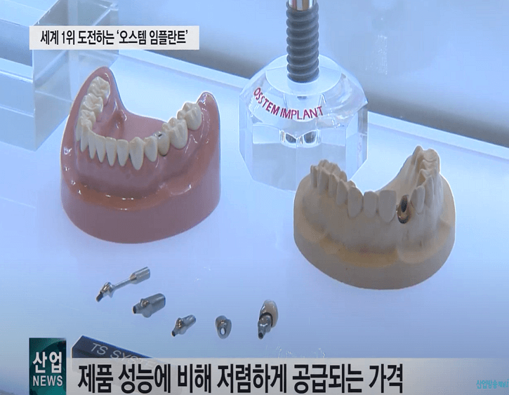 오스템임플란트 가격과 장점 3가지