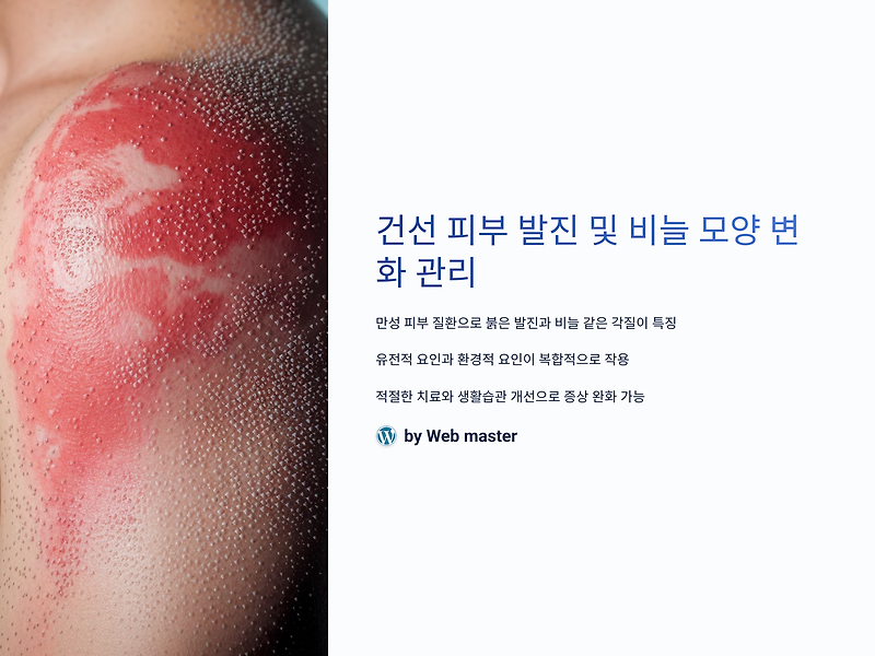 건선 피부 발진 및 비늘 모양 변화, 이것만 알면 관리가 쉬워진다!