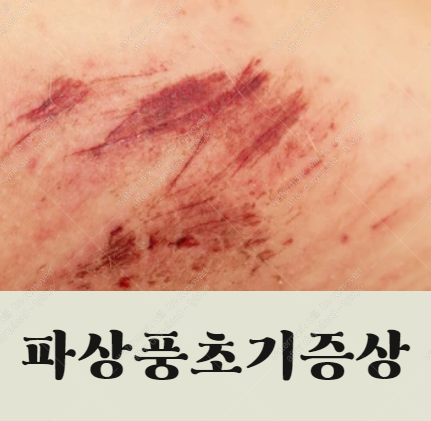 파상풍 초기증상 이걸 주목하세요.