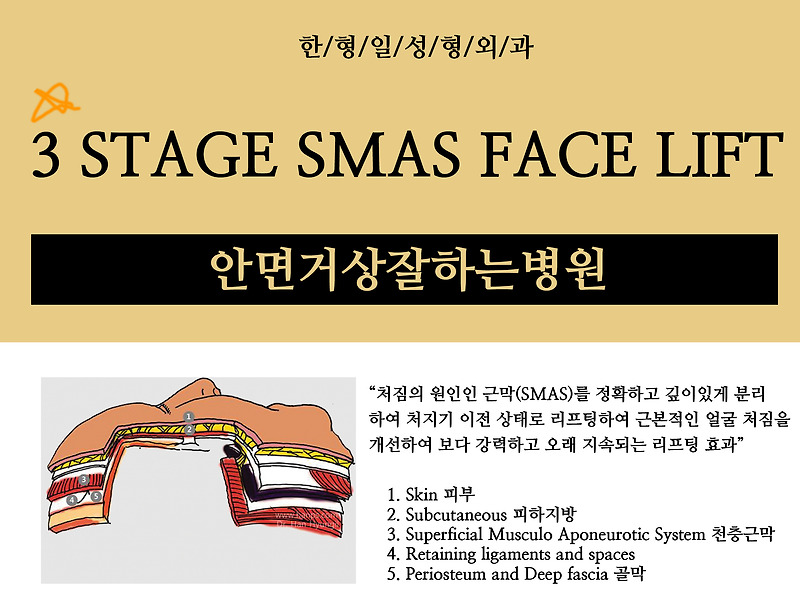 안면거상전문 수술방법 제대로 알아보기