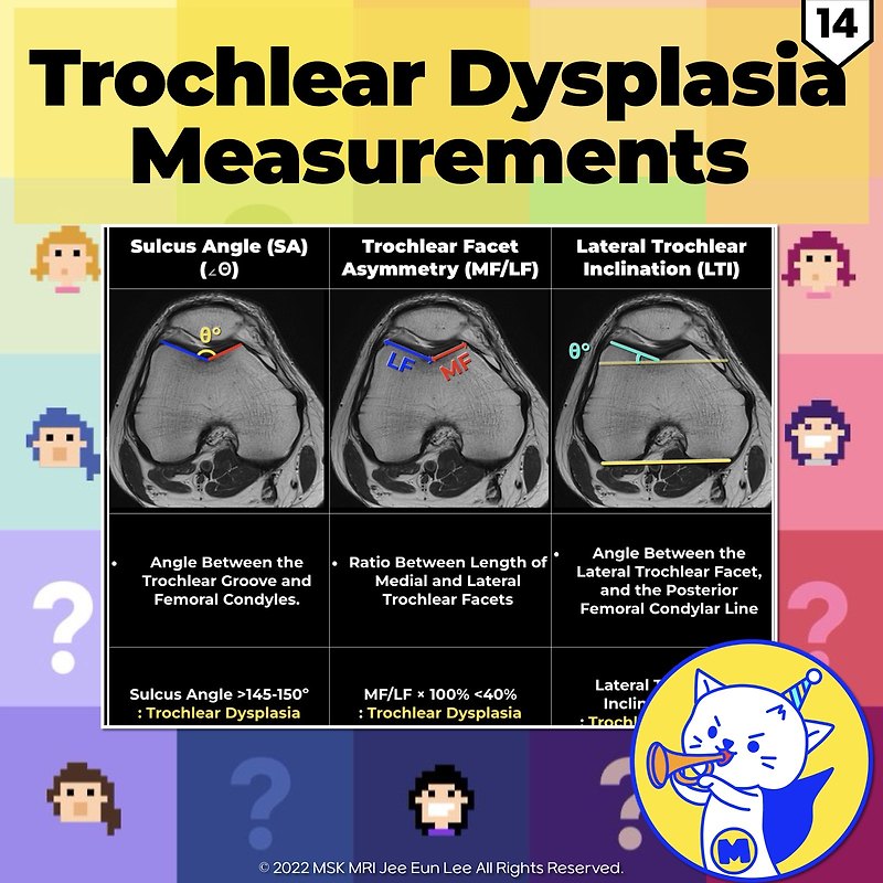 (Fig 4-A.14) Trochlear Dysplasia Assessment Measurements: Part 1