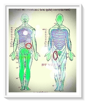 허벅지 대상포진 이정도는 알아야죠