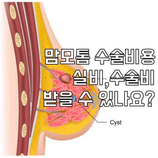 맘모톰 수술 1박 2일 입원 리뷰 제2탄 [선종 제거][통증, 비용]