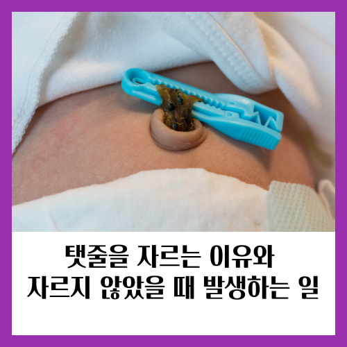 출생 후 신생아의 탯줄을 자르는 이유와 자르지 않았을 때 발생하는 일