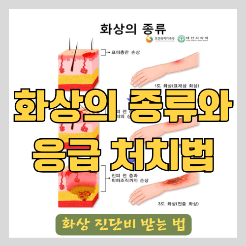 의료진이 알려주는 화상 종류(표재성,심재성)와 응급처치법(후시딘, 마데카솔, 화상연고, 메디폼, 바세린, 비판텐..) 그리고 ...
