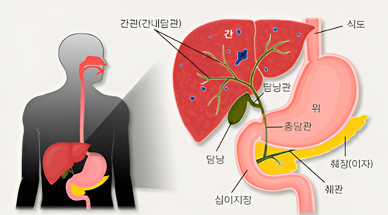 간염: 원인과 증상, 그리고 치료와 예방법