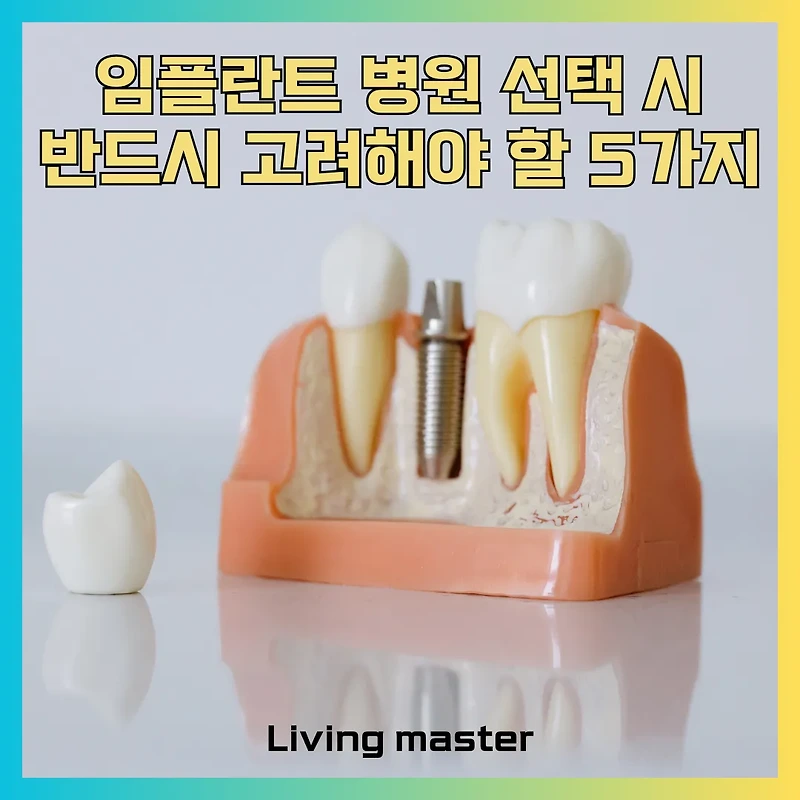 내 소중한 치아 맡길 곳은? 임플란트 병원 선택 시 반드시 고려해야 할 5가지