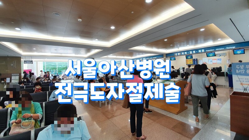 전극도자절제술 서울아산병원 에서 직접 시술 후기