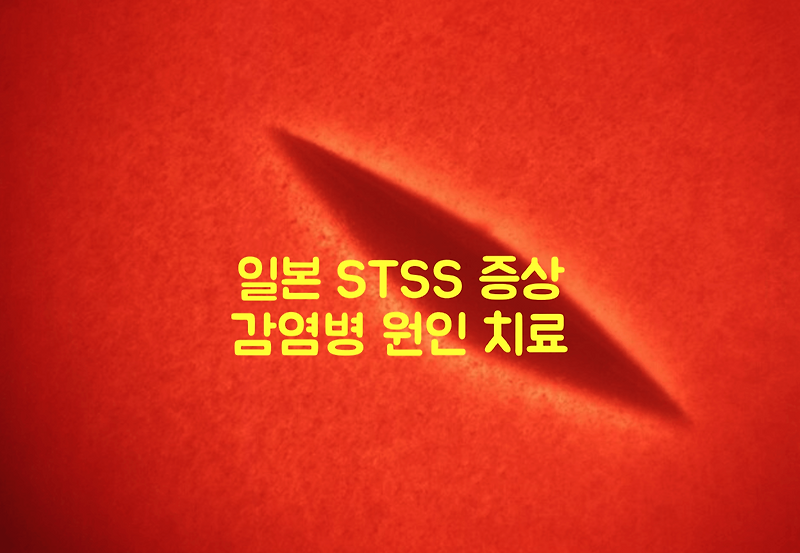 일본 STSS 증상 감염병 원인 치료
