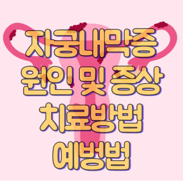 자궁내막증 원인 및 증상, 검사, 치료 방법, 예방법