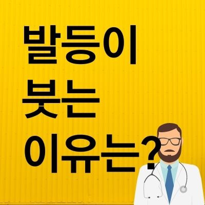 발등이 붓는 이유 이렇게 해결하세요