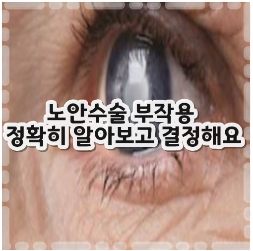 노안수술 부작용 정확히 알아보고 결정해요