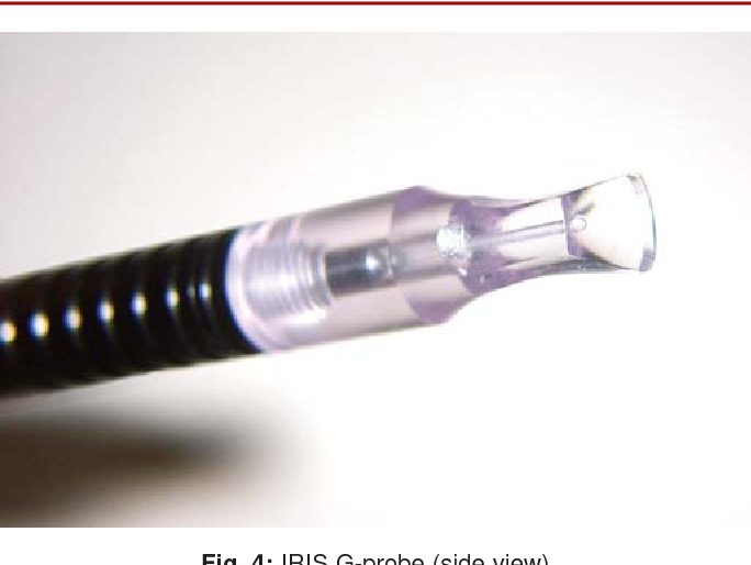 Diode Laser TransScleral CPC, 동공경유 광응고술, 눈속경유섬모체 광응고술