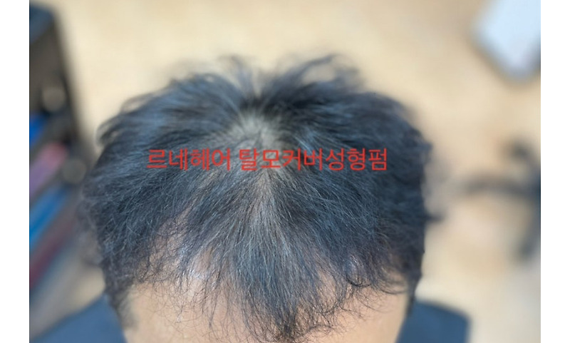 경상남도 김해에서 여기까지! 부산탈모케어커버성형펌 머리잘하는미용실추천헤어숍 르네시떼6층헤어