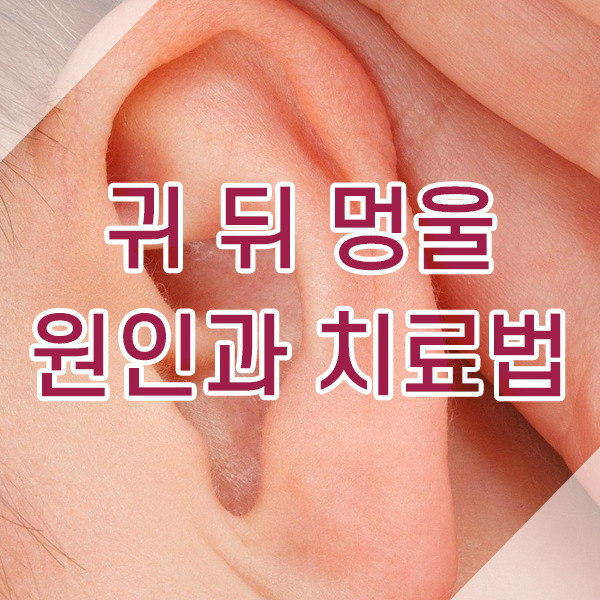 귀 뒤 염증은 당일 치료 가능한가요?