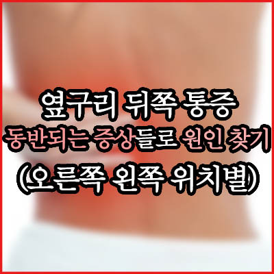 왼쪽 옆구리 뒤쪽 통증에 대해서 3