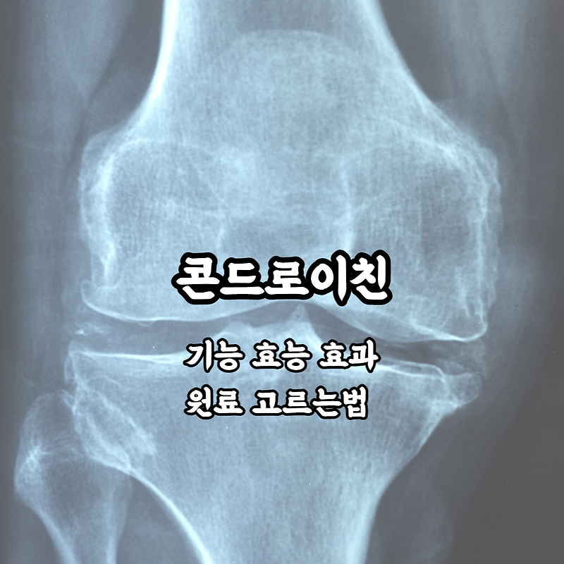 콘드로이친 기능과 효과 원료 고르는법 총정리