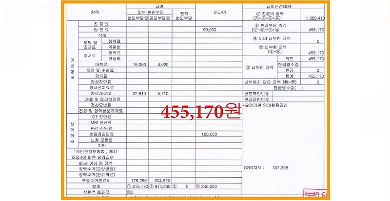 치질 치핵 수술 후기, 리가슈어 방법
