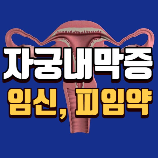 자궁내막증 임신 피임약, 검사 방법, 치료 쉽고 자세히 알아보기 :: 레이어플라이의 성장
