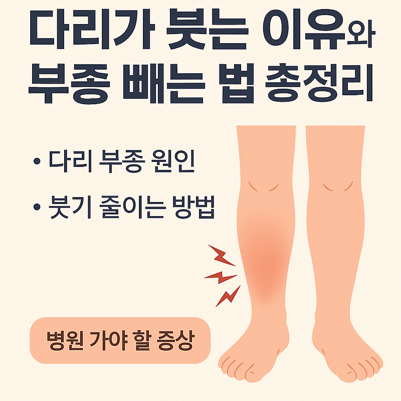 다리가 붓는 이유 총정리｜다리 부종 원인, 빼는법, 병원 가야 할 증상은?