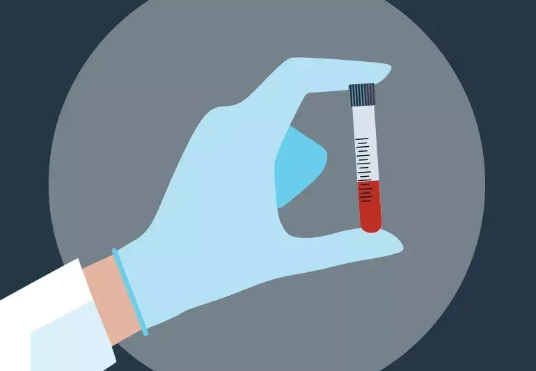 20대부터 시작하는 콜레스테롤 검사, 지금이 적기입니다