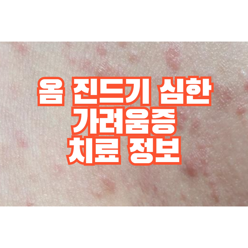 옴 진드기. 피부 발진, 대처방법