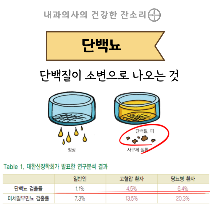 단백뇨, 왜 생기고 어떻게 치료할까? 원인부터 관리까지 총정리