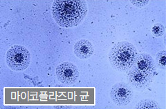 마이코플라스마 폐렴, 증상과 치료법 알아보기