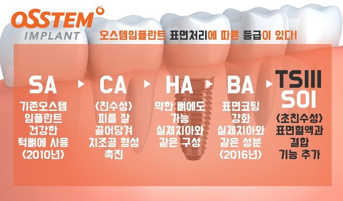 국산 오스템 임플란트 등급과 가격,