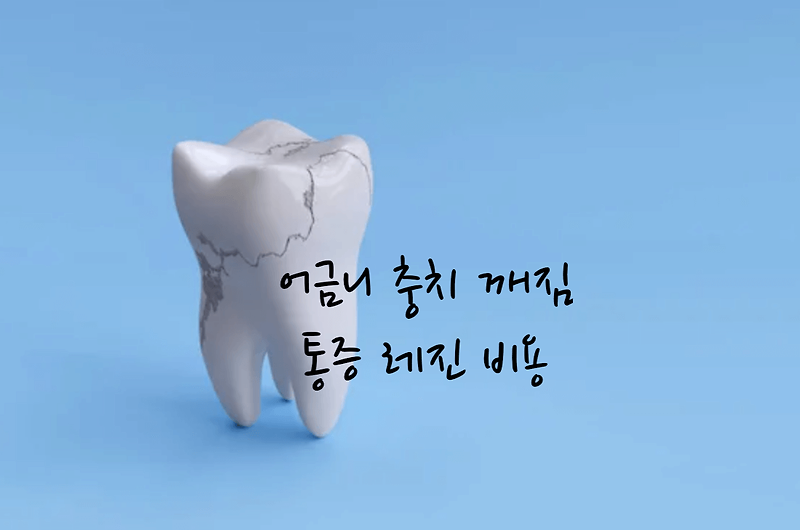 어금니 충치 깨짐 통증 레진 비용