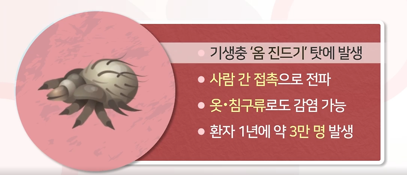 옴증상 원인 검사 치료 경과 합병증 예방방법