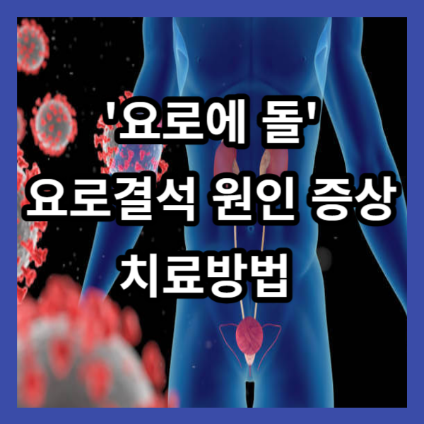 '요로에 돌' 요로결석의 원인 증상 치료방법
