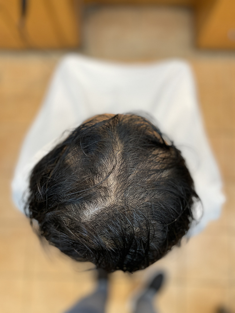 잃어버린 마음의 한가닥까지 채워드려요 남자탈모성형펌 부산사상르네시떼미용실/ 덕포덕천화명대저명지용원진해개금주례감전당감모라학장하단김해녹산장유