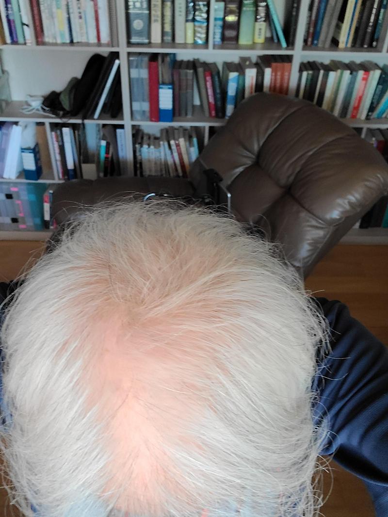 "모다모다" 샴푸의 효과