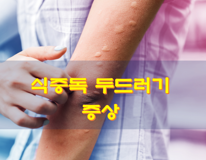 식중독 두드러기 증상