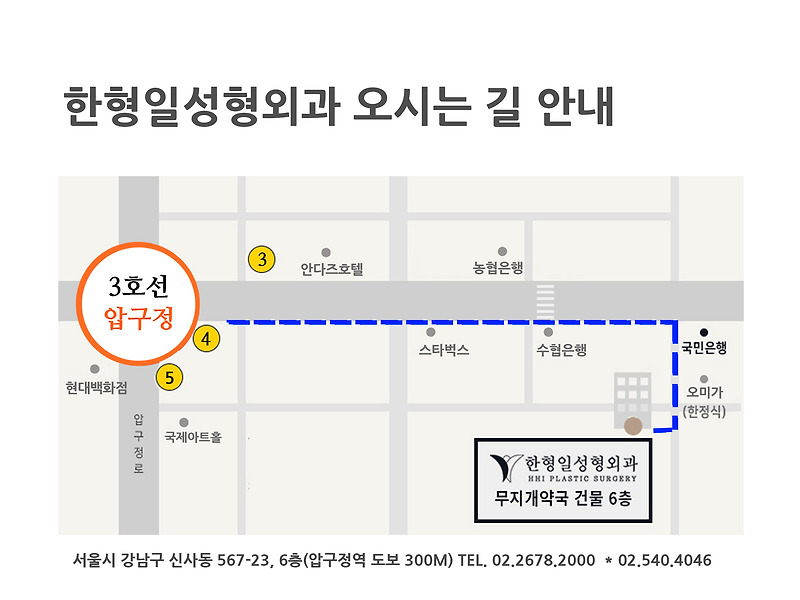 안면거상잘하는곳, 후회없는 선택을 위한 가장 중요한 것!