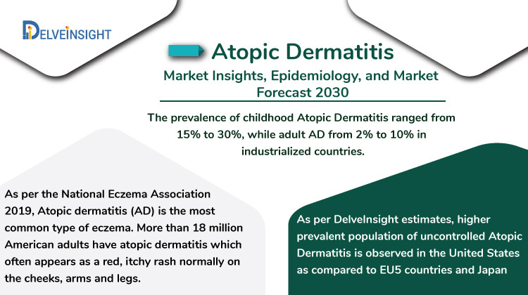 Atopic Dermatitis Market Analysis And Market Forecast 2030 2732