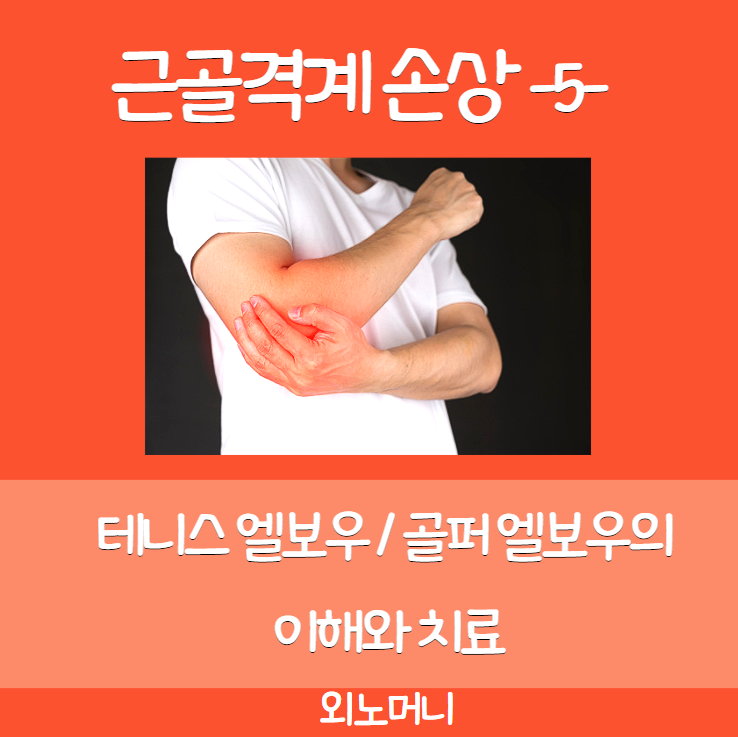 [근골격계 손상]지긋지긋한 팔꿈치 통증! 테니스엘보우, 골퍼엘보우에 대한 이해와 치료. (가쪽 / 안쪽 위관절융기염)