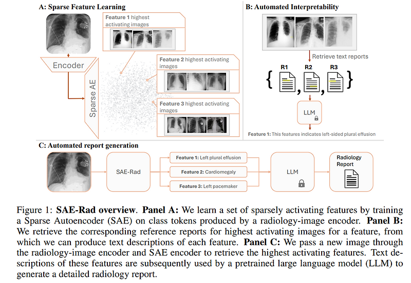 An X-Ray Is Worth 15 Features: Sparse Autoencoders for Interpretable ...