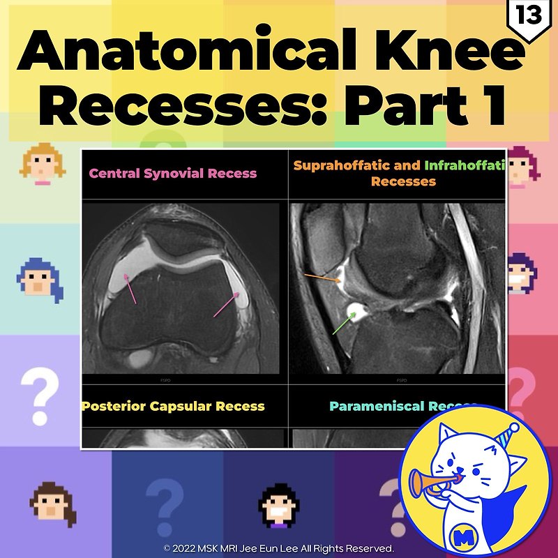 (Fig 4-D.13) Anatomical Knee Recesses: Part 1