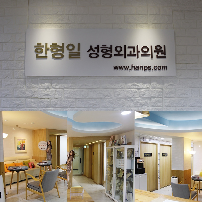 안면거상술 유지기간 대략 10년?