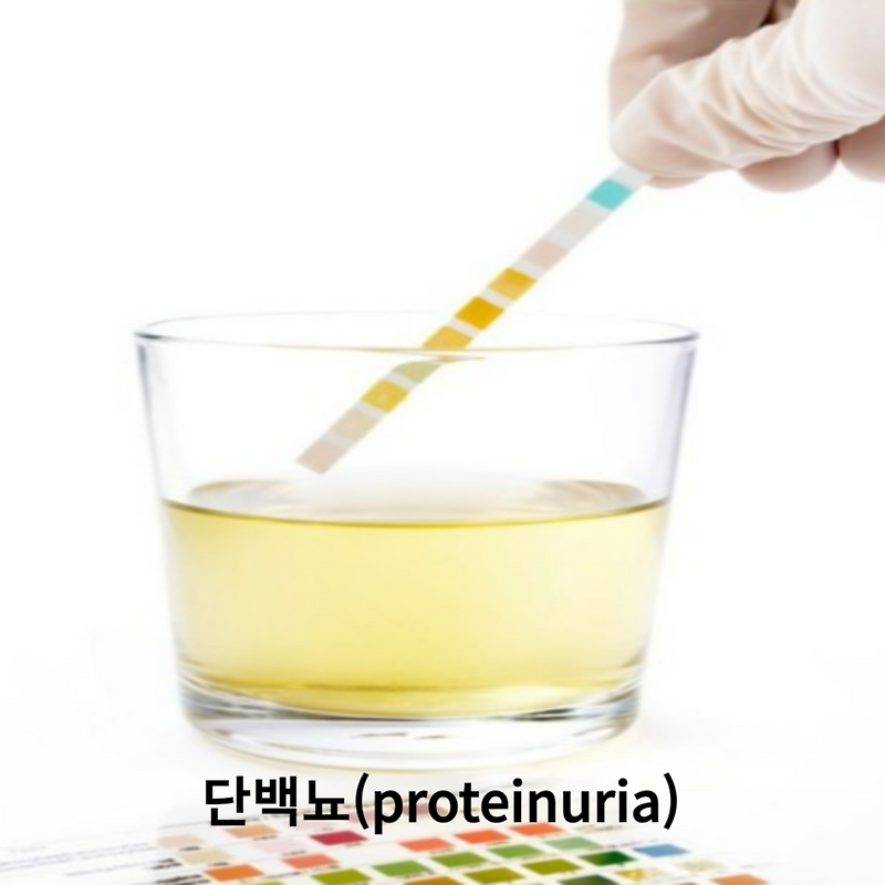 단백뇨의 신호, 단백뇨 증상과 치료