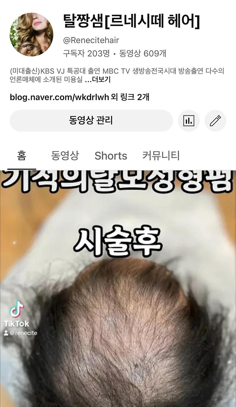 머리잘하는부산탈모 남자탈모커버 중년남자탈모예방 관리 커버 성지미용실 사상구 추천잘하는미용실 르네시떼6층헤어샵