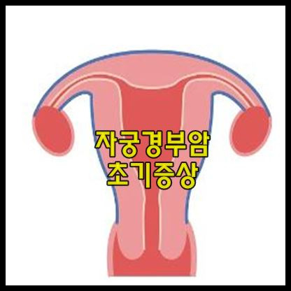 자궁경부암 발병 원인 및 초기 증상 알아보기