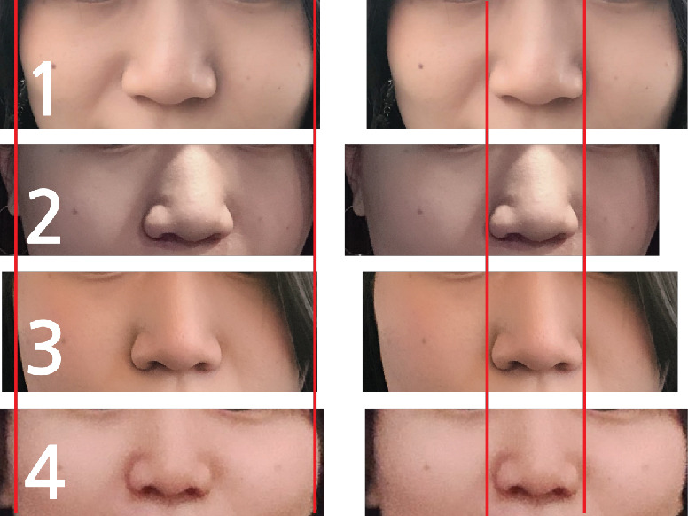 얼굴이 작아지는 방법 프리셔리 탄력 롤러 크림 괄사 마사지로 얼굴의 붓기를 없애다